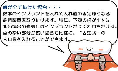 歯が全て抜けた場合・・・数本のインプラントを入れて入れ歯の固定源となる維持掃除を取り付けます。特に、下顎の歯が１本も無い場合の修復にはインプラントがよく利用されます。歯のない部分が広い場合も同様に、”固定式”の人口歯を入れることができます。